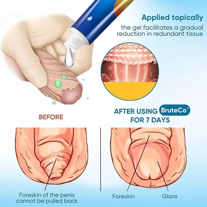 Bruteco Redundant Prepuce Corrective Gel, Bruteco Corrective Gel, Prepuce Corrective Gel, Corrective Gel, Suitable for Men's Health, Excessive Preparation Correction