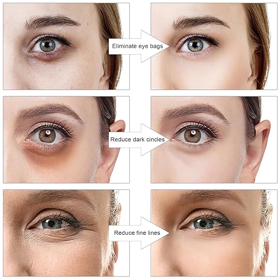 NANSIKE Under Eye Red Light Therapy Glasses, with Eye Massage for Dark Circles, Eye Bags and Eye Wrinkle Elimination